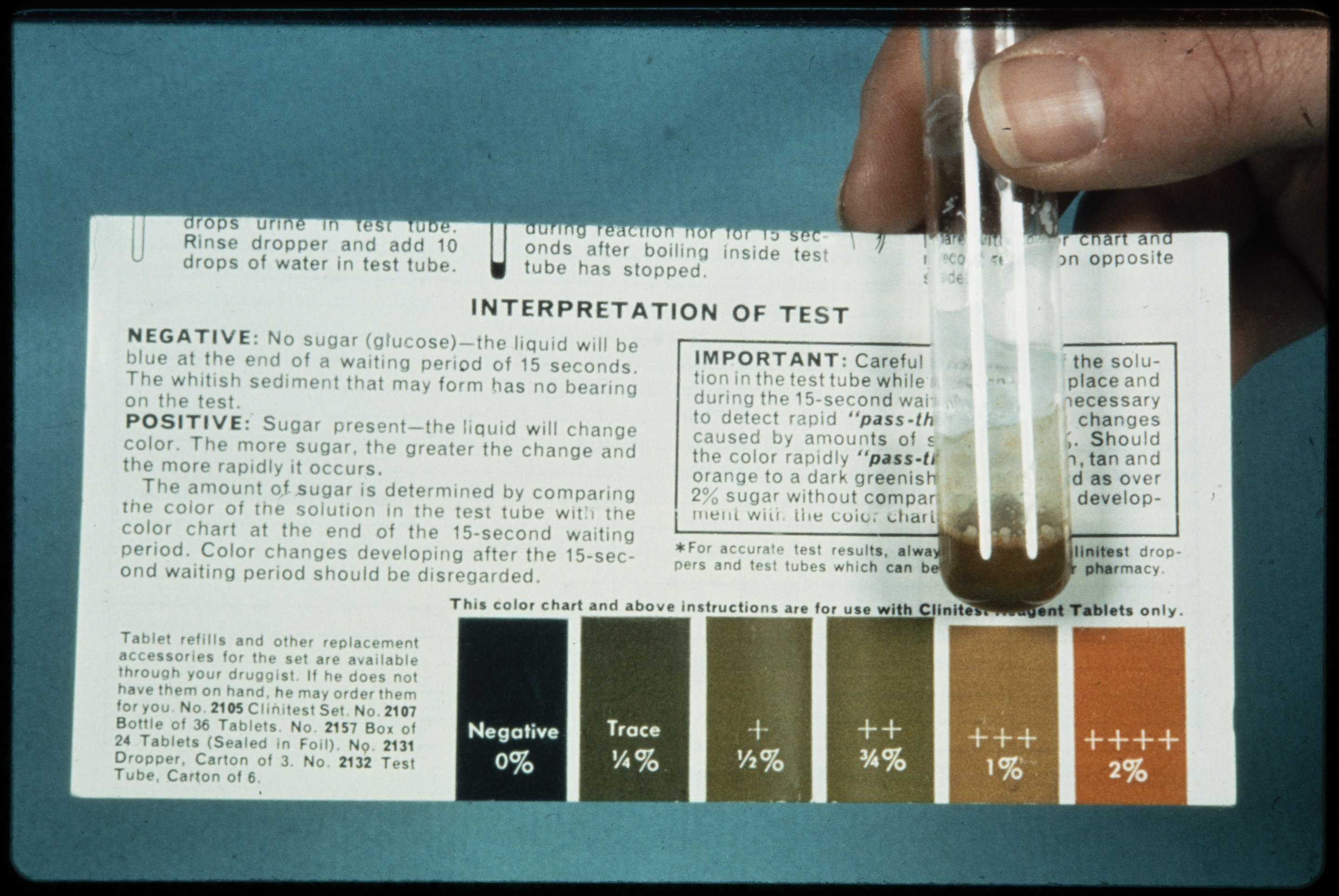 Urine for sugar test