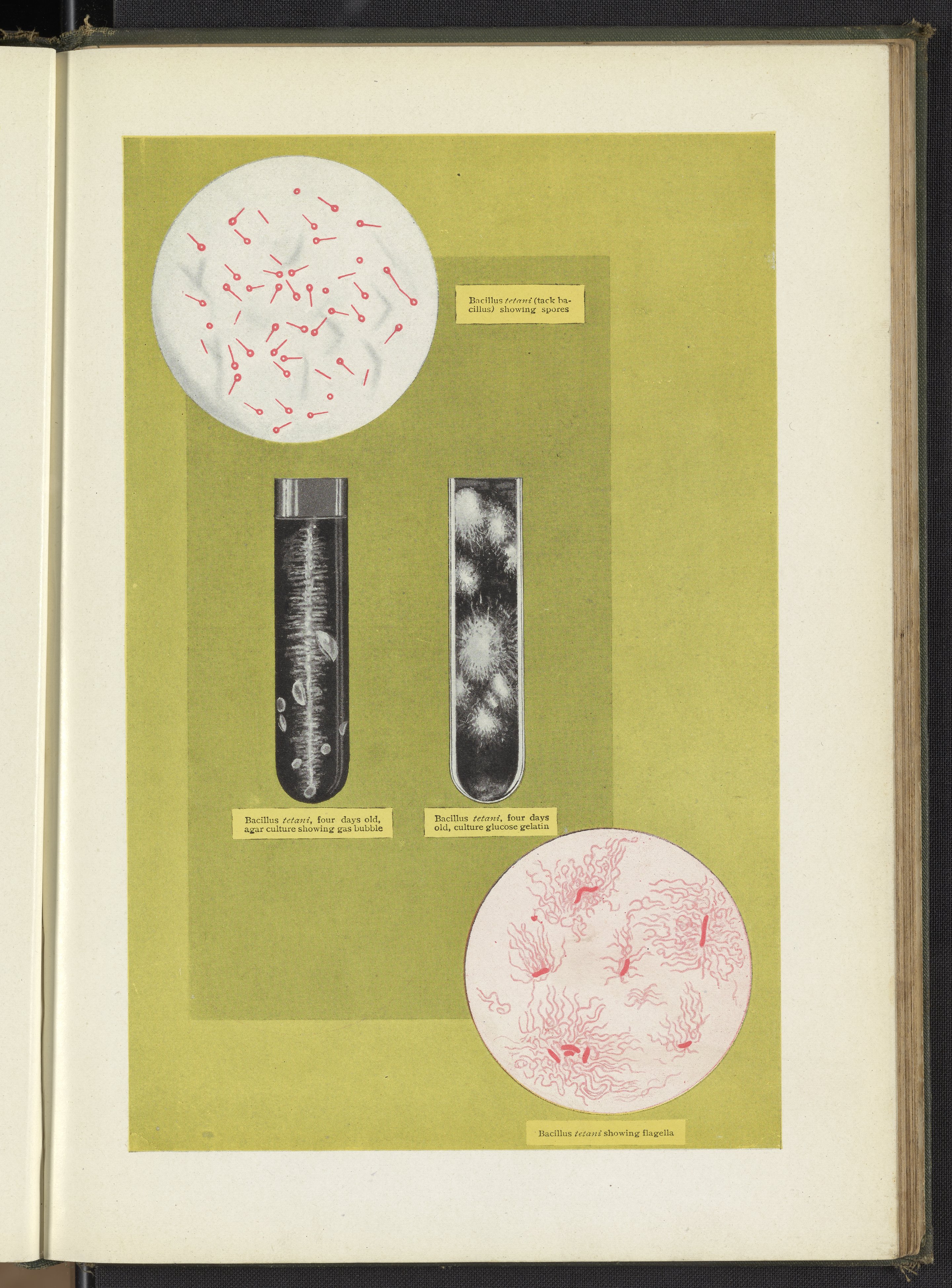 clostridium tetani bacteria